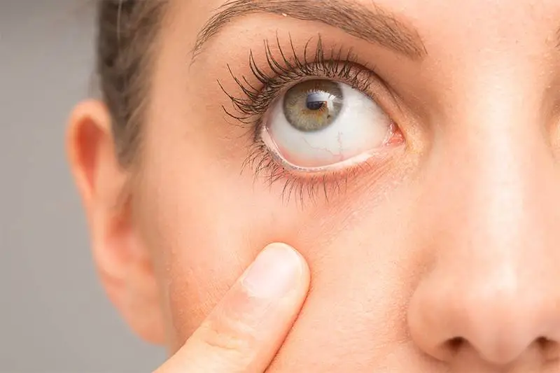 Tique no olho causas